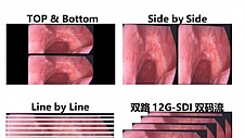 精准影像,立体呈现 | 海信4K 3D内窥显示器革新医疗显示体验